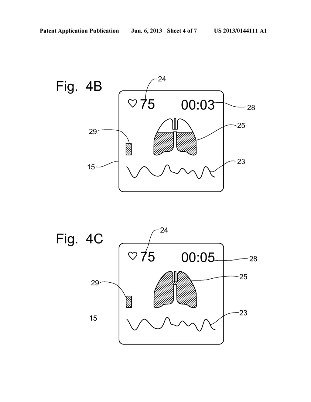 Method and Apparatus for Managing Stress - diagram, schematic, and image 05