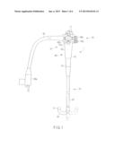 ENDOSCOPE diagram and image