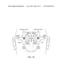 OCULAR INSERT APPARATUS AND METHODS diagram and image