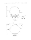 OCULAR INSERT APPARATUS AND METHODS diagram and image