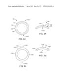 OCULAR INSERT APPARATUS AND METHODS diagram and image