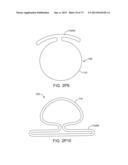 OCULAR INSERT APPARATUS AND METHODS diagram and image