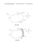 OCULAR INSERT APPARATUS AND METHODS diagram and image