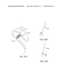 OCULAR INSERT APPARATUS AND METHODS diagram and image