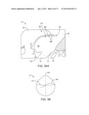 OCULAR INSERT APPARATUS AND METHODS diagram and image