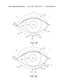 OCULAR INSERT APPARATUS AND METHODS diagram and image