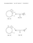 OCULAR INSERT APPARATUS AND METHODS diagram and image