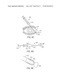 OCULAR INSERT APPARATUS AND METHODS diagram and image