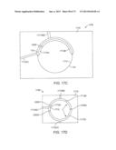 OCULAR INSERT APPARATUS AND METHODS diagram and image