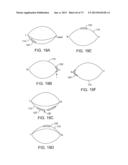 OCULAR INSERT APPARATUS AND METHODS diagram and image