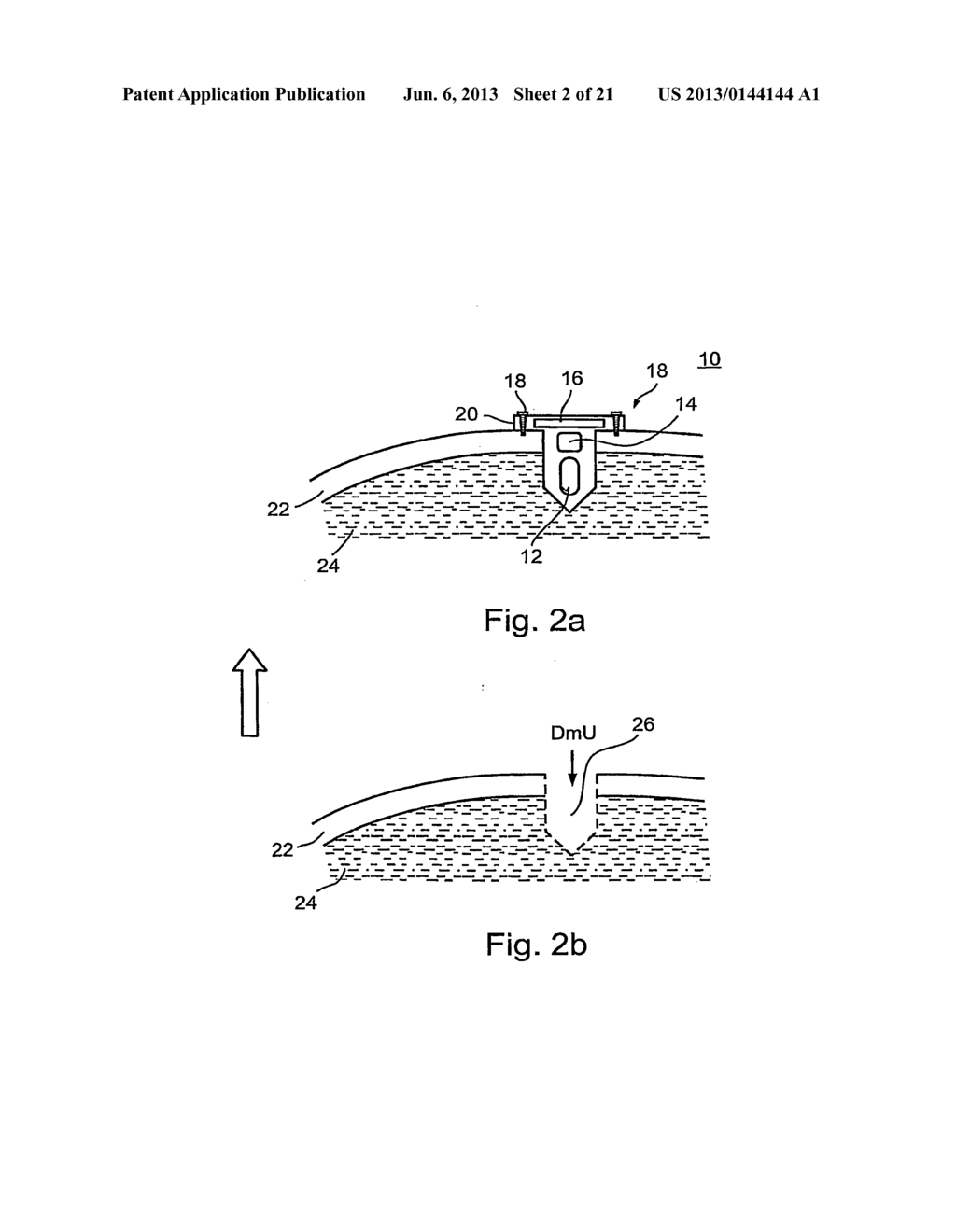 DEVICE SYSTEM AND METHOD FOR MONITORING AND CONTROLLING BLOOD ANALYTE     LEVELS - diagram, schematic, and image 03