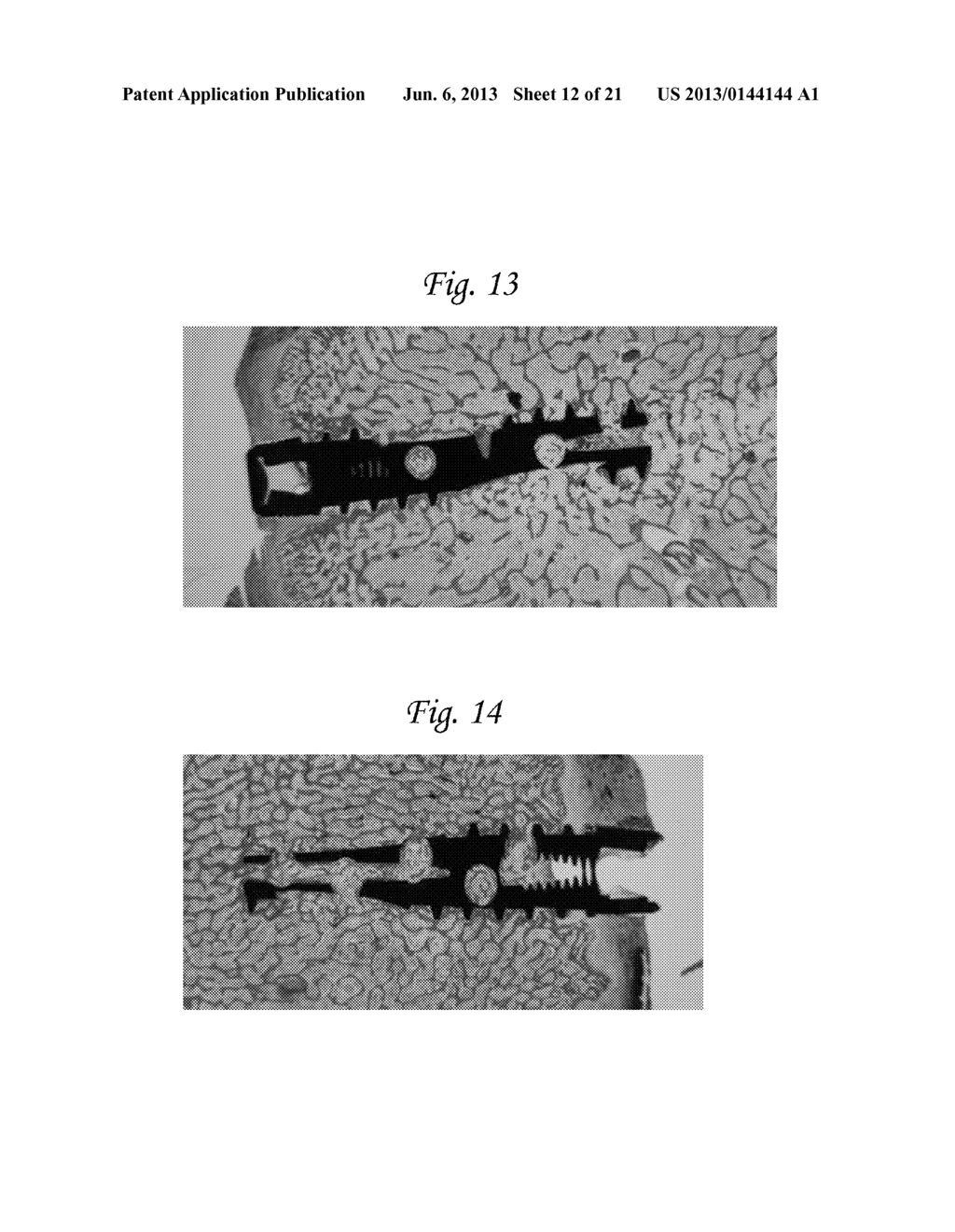 DEVICE SYSTEM AND METHOD FOR MONITORING AND CONTROLLING BLOOD ANALYTE     LEVELS - diagram, schematic, and image 13