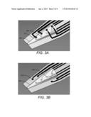 IMPLANTABLE NEURAL TISSUE REPORTING PROBE AND METHODS OF MANUFACTURING AND     IMPLANTING SAME diagram and image