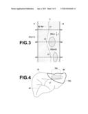 IMAGE-BASED DIAGNOSIS ASSISTANCE APPARATUS, METHOD AND PROGRAM diagram and image