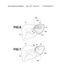 IMAGE-BASED DIAGNOSIS ASSISTANCE APPARATUS, METHOD AND PROGRAM diagram and image