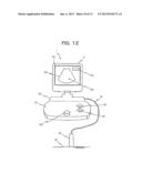 ULTRASOUND DIAGNOSIS DEVICE diagram and image