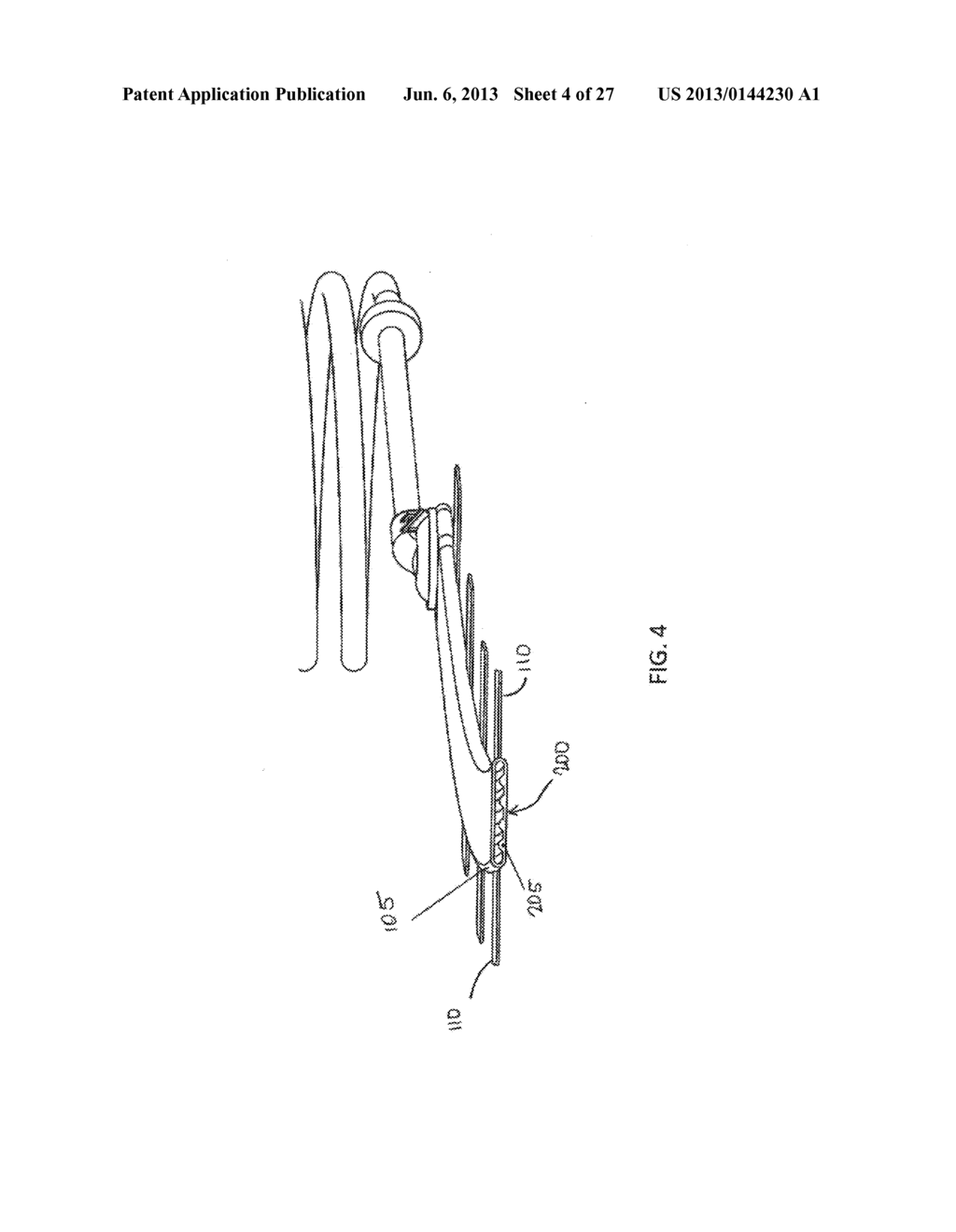 SOLUTIONS FOR BRIDGING AND PRESSURE CONCENTRATION REDUCTION AT WOUND SITES - diagram, schematic, and image 05