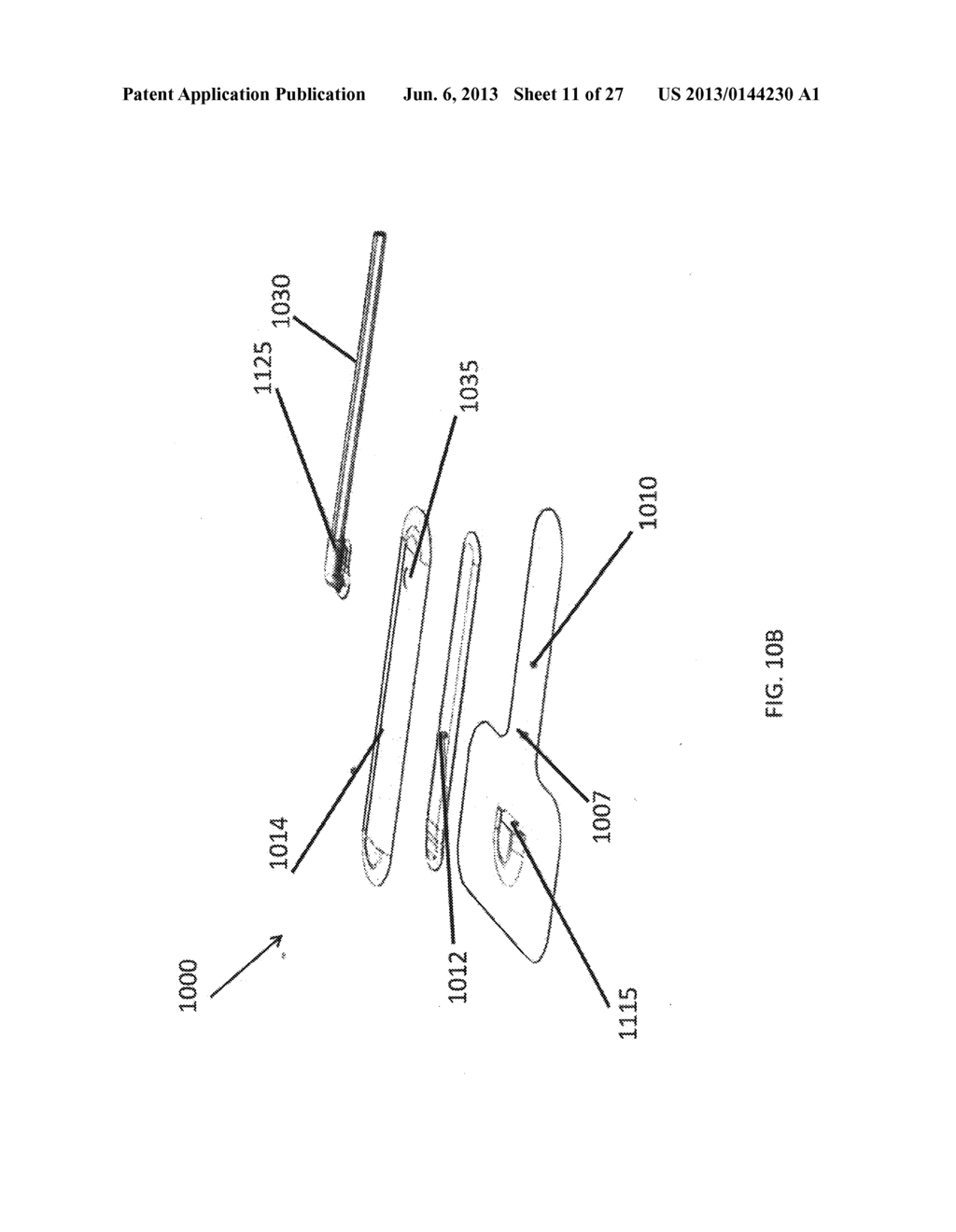 SOLUTIONS FOR BRIDGING AND PRESSURE CONCENTRATION REDUCTION AT WOUND SITES - diagram, schematic, and image 12