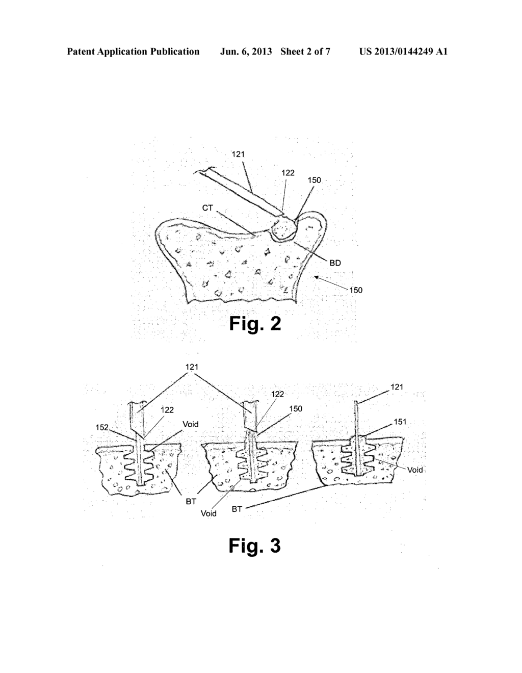 ADHESIVE DELIVERY DEVICES, SYSTEMS AND METHODS - diagram, schematic, and image 03