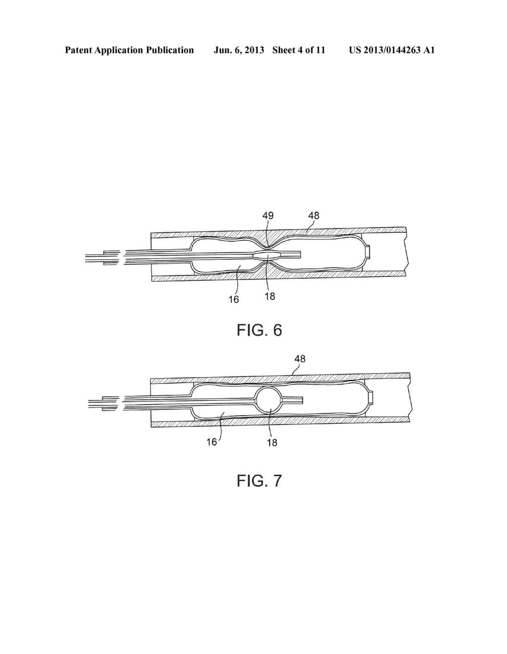 BALLOON CATHETER SYSTEM - diagram, schematic, and image 05