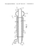 STRICTURE TREATMENT AND DRAINAGE CATHETER diagram and image