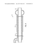 STRICTURE TREATMENT AND DRAINAGE CATHETER diagram and image