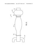 STRICTURE TREATMENT AND DRAINAGE CATHETER diagram and image