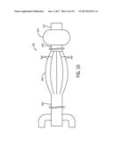 STRICTURE TREATMENT AND DRAINAGE CATHETER diagram and image