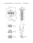 METHOD AND DEVICE FOR PRODUCING AN ANCHORAGE IN HUMAN OR ANIMAL TISSUE diagram and image