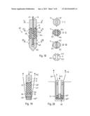 METHOD AND DEVICE FOR PRODUCING AN ANCHORAGE IN HUMAN OR ANIMAL TISSUE diagram and image