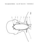 CLOT CAPTURE SYSTEMS AND ASSOCIATED METHODS diagram and image