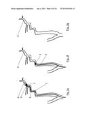 CLOT CAPTURE SYSTEMS AND ASSOCIATED METHODS diagram and image