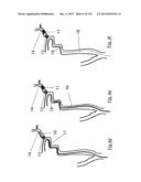 CLOT CAPTURE SYSTEMS AND ASSOCIATED METHODS diagram and image