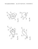 CLOT CAPTURE SYSTEMS AND ASSOCIATED METHODS diagram and image