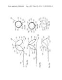 CLOT CAPTURE SYSTEMS AND ASSOCIATED METHODS diagram and image