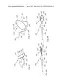 CLOT CAPTURE SYSTEMS AND ASSOCIATED METHODS diagram and image