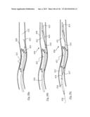 CLOT CAPTURE SYSTEMS AND ASSOCIATED METHODS diagram and image