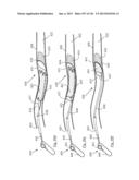 CLOT CAPTURE SYSTEMS AND ASSOCIATED METHODS diagram and image