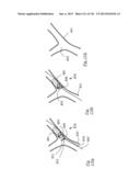 CLOT CAPTURE SYSTEMS AND ASSOCIATED METHODS diagram and image