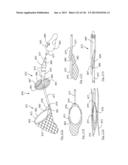 CLOT CAPTURE SYSTEMS AND ASSOCIATED METHODS diagram and image