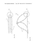 CLOT CAPTURE SYSTEMS AND ASSOCIATED METHODS diagram and image