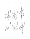 CLOT CAPTURE SYSTEMS AND ASSOCIATED METHODS diagram and image