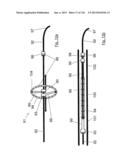 CLOT CAPTURE SYSTEMS AND ASSOCIATED METHODS diagram and image