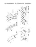 CLOT CAPTURE SYSTEMS AND ASSOCIATED METHODS diagram and image