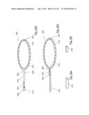 CLOT CAPTURE SYSTEMS AND ASSOCIATED METHODS diagram and image