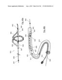 CLOT CAPTURE SYSTEMS AND ASSOCIATED METHODS diagram and image