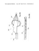 CLOT CAPTURE SYSTEMS AND ASSOCIATED METHODS diagram and image