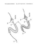 CLOT CAPTURE SYSTEMS AND ASSOCIATED METHODS diagram and image