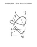 CLOT CAPTURE SYSTEMS AND ASSOCIATED METHODS diagram and image