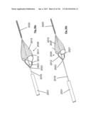 CLOT CAPTURE SYSTEMS AND ASSOCIATED METHODS diagram and image